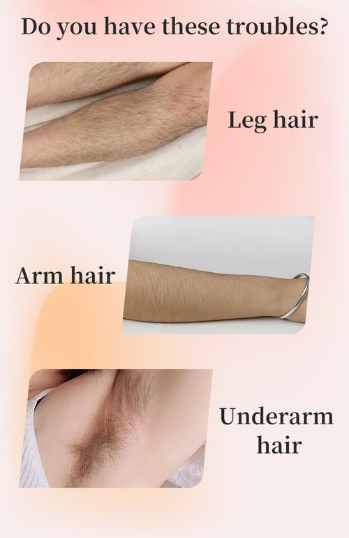Illustration of leg, arm, and underarm hair with text asking if you have these troubles on a pink background.